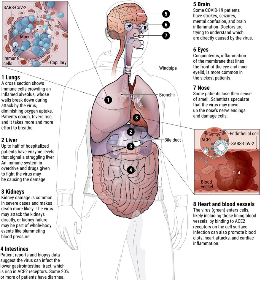 How Covid-19 attacks the human body