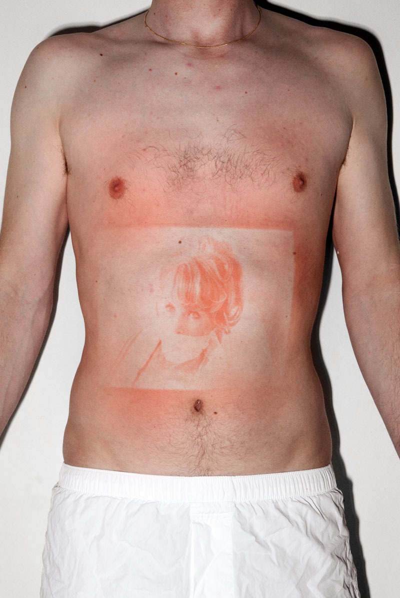 a person's stomach with a photo 'sunburnt' onto it with a UV light