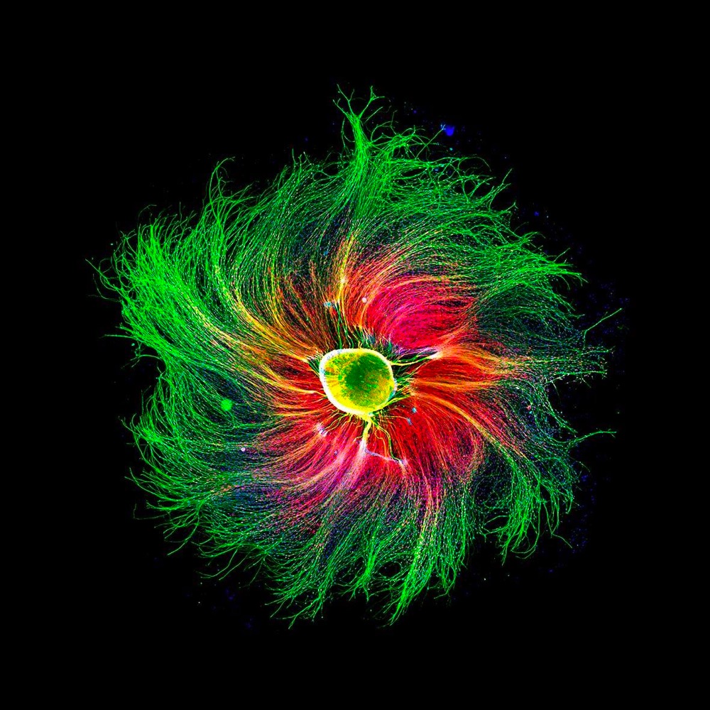 Sensory neuron from an embryonic rat